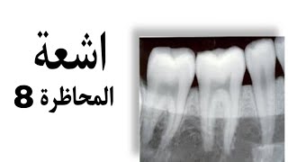 اشعة Digital image طب الأسنان مرحلة ثالثة Radiology [upl. by Biron]