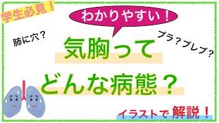 教科書をわかりやすく！「気胸ってどんな病態？」 [upl. by Iror987]