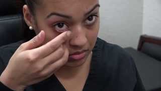 How to Apply Ointment to the Eyes and Eyelids [upl. by Wickham]