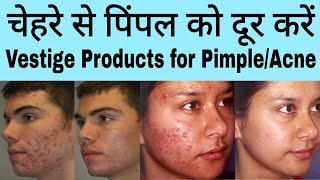 Vestige Products For AcnePimple  Vestige Skin Care Products [upl. by Dalury]