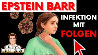 Epstein Barr Virus Die Immunologischen Folgen EBV Infektion wissenschaftlich erklärt [upl. by Yatnwahs]