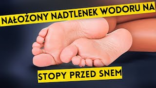 Oto Co Się Stało Już Po 2 Razach Nadtlenek Wodoru na Stopy [upl. by Giffie]