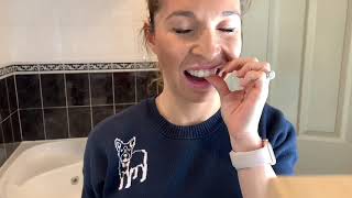 Joanas Tooth Whitening Journey [upl. by Verada]