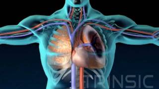 Pulmonary Embolism Medical Animation [upl. by Tarttan]