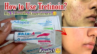 My 2 Months Experience with Tretinoin  How to Use Skin A cream  How to use Adapco cream [upl. by Millwater782]