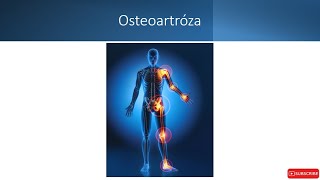 Osteoartróza v 19 minutách [upl. by Gauthier479]