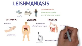 What is Leishmaniasis An introduction and overview [upl. by Deena414]