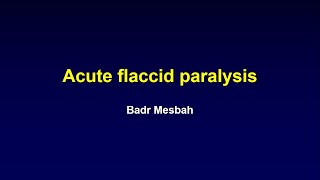 Acute Flaccid Paralysis AFD [upl. by Close]