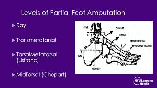 Lower Limb Orthotics and Prosthetics  ABOS Orthopedic Surgery Board Exam Review [upl. by Igal]