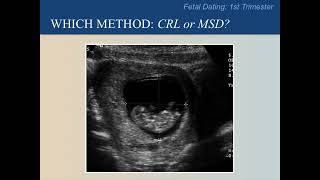 Ultrasound Training Course 09 part 2 [upl. by Naeruat]