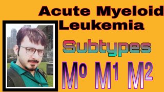 Acute Myeloid Leukemia Subtypes M⁰M¹M² [upl. by Ettennat627]