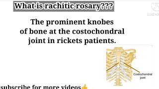 What is rachitic rosary  Rachitic Rosary vitamin C deficient disease  Basic concept building [upl. by Elcin]