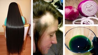 Get Long Thicken HAIR Onion amp Ginger Oil  Magical Home Remedy to Hair Regrowth Urdu Hindi [upl. by Dnomed]