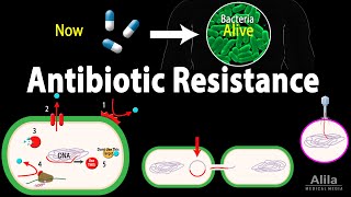 Antibiotic Resistance Animation [upl. by Selene]