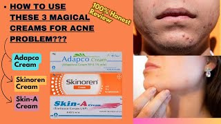 How To Use Adapco Skinoren and Skin A Cream  How To Apply Adapco Skin A and Skinoren Cream [upl. by Enortna]