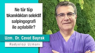 Ne tür tüp tıkanıklıkları selektif salpingografi ile açılabilir [upl. by Thomas114]