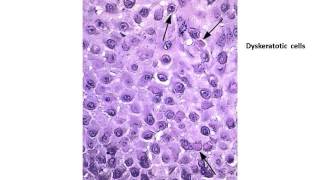 Answers to Basic dermatopathology quiz Dr shashikala krishnamurthy [upl. by Ynohtnaed]