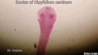 Dipyilidium caninum [upl. by Camp]