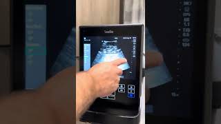 Sonosite s2 bladder scanner function [upl. by Aokek]