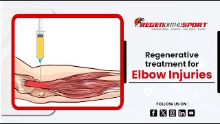 RegenOrthoSport Concentrated Platelet Therapy for Elbow Injuries  RegenOrthoSport [upl. by Ruffo]