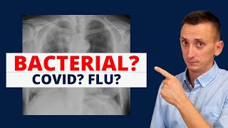 Covid Influenza Pneumonia [upl. by Marika]