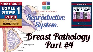 Breast pathologyCancer from Pathoma in urdu Part4 Reproductive system pathUrduHindi [upl. by Huntingdon]