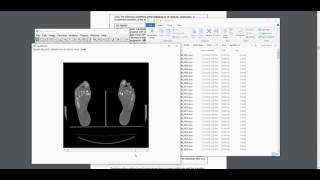 Primer on working with dicom data [upl. by Clayton]