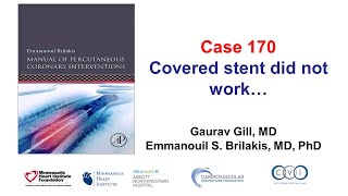 Case 170 Manual of PCI  Covered stent did not work [upl. by Aiht]