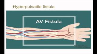 10minute Rounds Outflow Stenosis and the Arteriovenous Fistula [upl. by Eimerej]