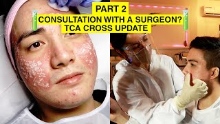 SEVERE ACNE SCARS AND FOLLOW UP CONSULTATION  My TCA CROSS Experience Philippines  Envi Part 2 [upl. by Narda]