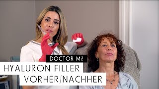 Hyaluron Filler Vorher  Nachher  DOCTOR MI Folge 9 [upl. by Rammaj]