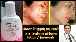 Moiz cleansing lotion  moiz cleanser for sensitive skin  best facewash acne pimples dryskin [upl. by Hey]