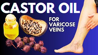 CASTOR OIL – A Natural Remedy for Varicose Veins [upl. by Aubarta]