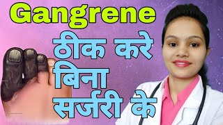 Top Best Homoeopathic medicine for Gangrene in hindi [upl. by Ursala3]