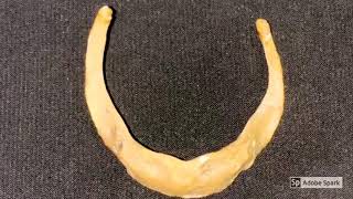 Hyoid bone [upl. by Jovi]