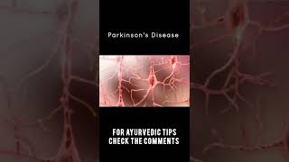 Parkinsons Disease Is Curable shorts ayurveda [upl. by Fran]