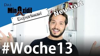 Neustart mit dem Minoxidil Schaum  Das Minoxidil Experiment Woche13 [upl. by Tnias]