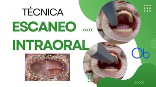 Técnica de Escaneo intraoral [upl. by Sarad]