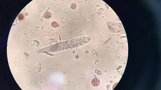 Demodex under the Microscope [upl. by Nannette]