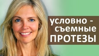 😃 Протез на имплантах Что такое условно съемный протез зубов на имплантах Стоматология Тандем [upl. by Oster]