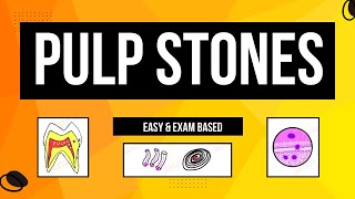 Denticles  Pulp Stones Classification  Age change in pulp [upl. by Hepsibah303]