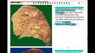 Intro to pathology Acute inflammation Lab 2 [upl. by Finnigan]