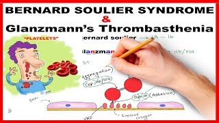 Bernard Soulier Syndrome amp Glanzmanns Thrombasthenia  Mnemonic Series  21 [upl. by Damick898]