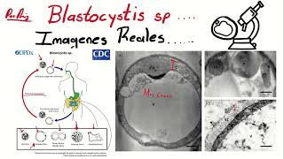 Blastocystis hominis al microscopio óptico [upl. by Sig]