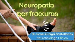 ¡NEUROPATÍA POR FRACTURAS [upl. by Bussy453]