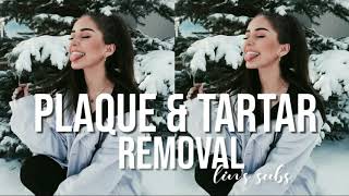 Plaque amp Tartar Removal request  Subliminal [upl. by Enelak]