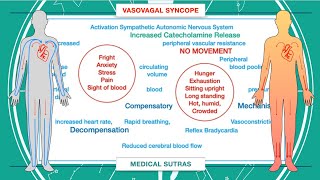 What is syncope and how to manage it [upl. by Wawro]