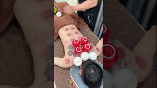 ASMR Chinese Cupping Therapy asmr cuppingtherapy youtubeshorts china [upl. by Oswell]