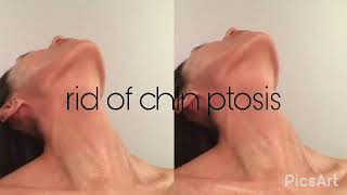 rid of chin ptosis ♡ subliminal ♡ [upl. by Charlena842]