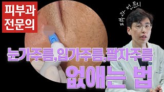 눈가주름입가주름팔자주름 없애는법 [upl. by Eeniffar]